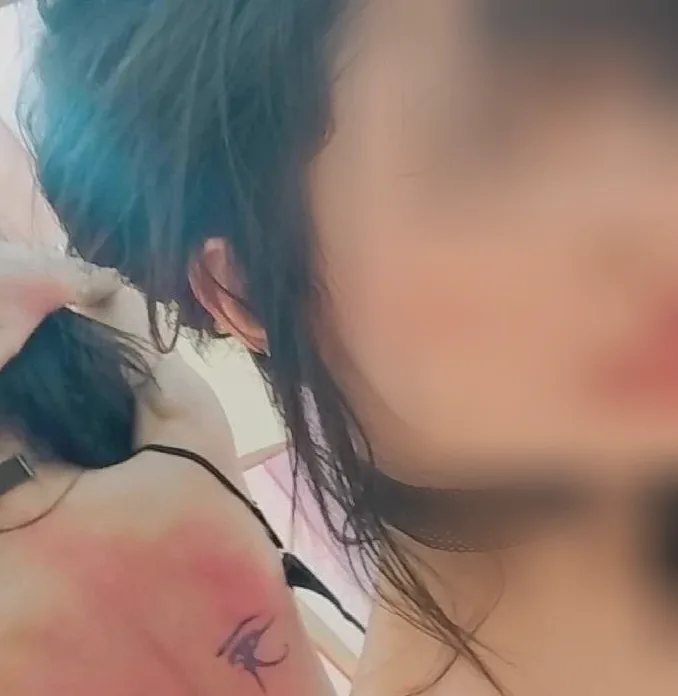 Hanna, 25